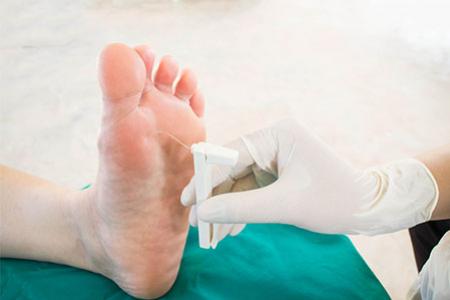 แผลเบาหวาน (DIABETIC FOOT) และการดูแลเท้ารักษาเท้า