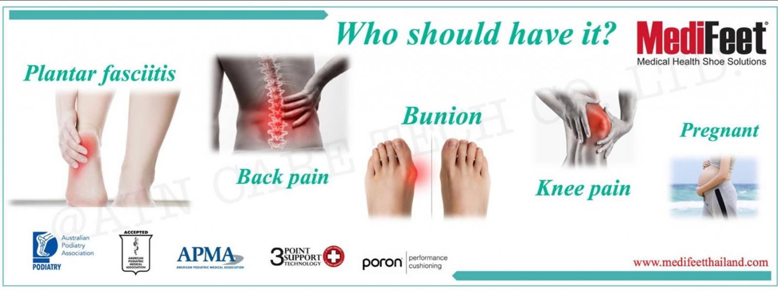 Plantar Fasciitis Back Pain Bunion Knee Pain Pregnant
